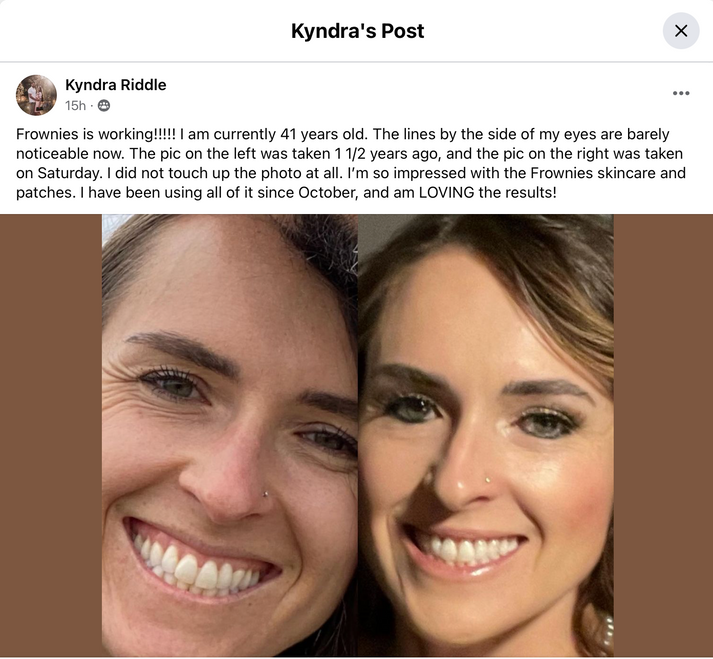 Testimonial of how well Frownies work