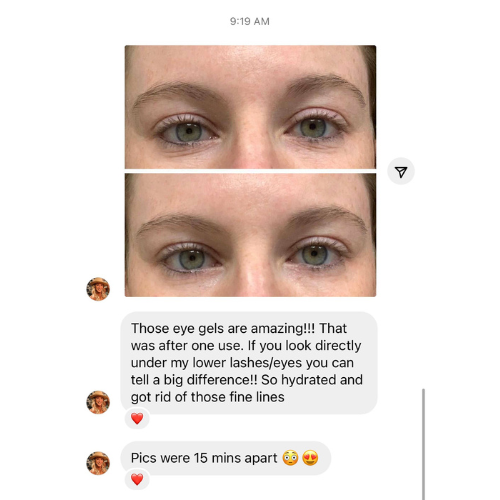 Frownies Under Eye Gels customer review with before and after photos